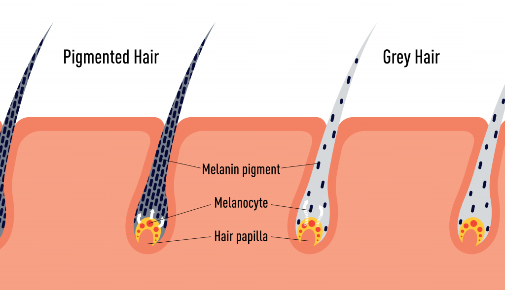 Premature Greying – Should You Really Worry About It? diagram of premature grey hair