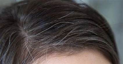 Premature Greying – Should You Really Worry About It? premature greying hair